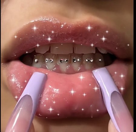 أحجار لامعة للأسنان – Tooth Jewelry